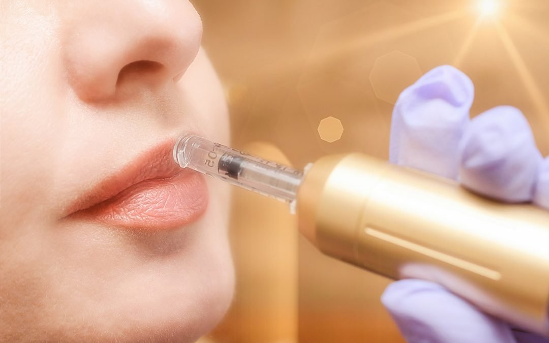 Hidrata tus labios con Hyaluron Pen