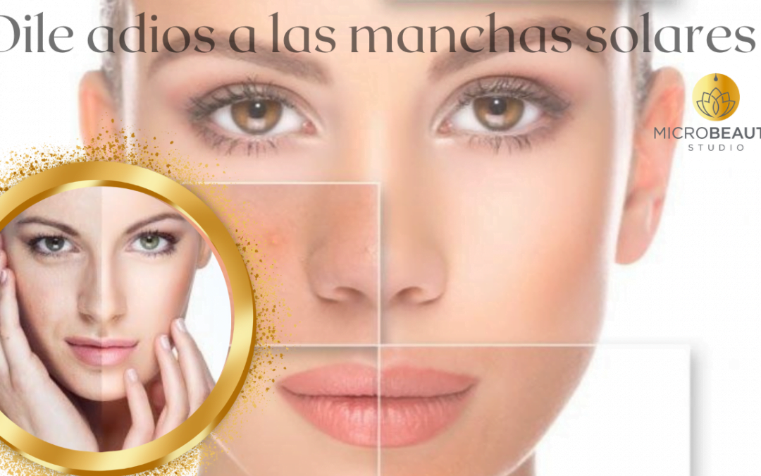 Elimina las Manchas Solares del Verano