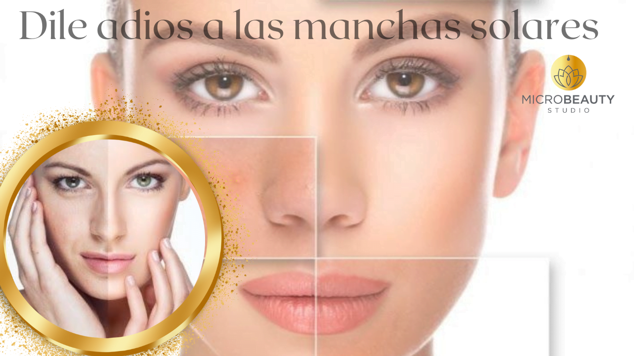 Eliminación Manchas Solares Eliminación manchas solares faciales