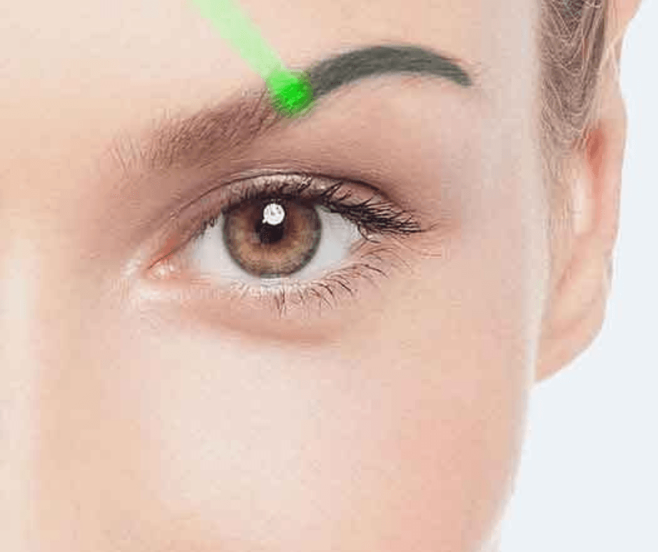 Eliminación Laser Microblading y Micropigmentación