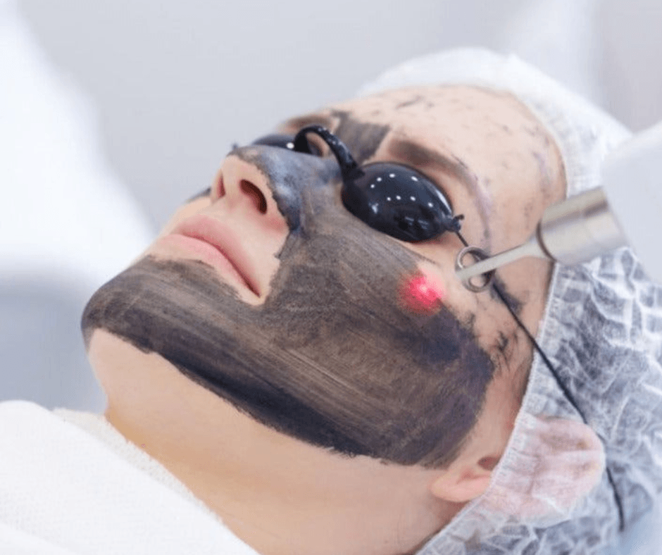 Tratamiento Hollywood Peel