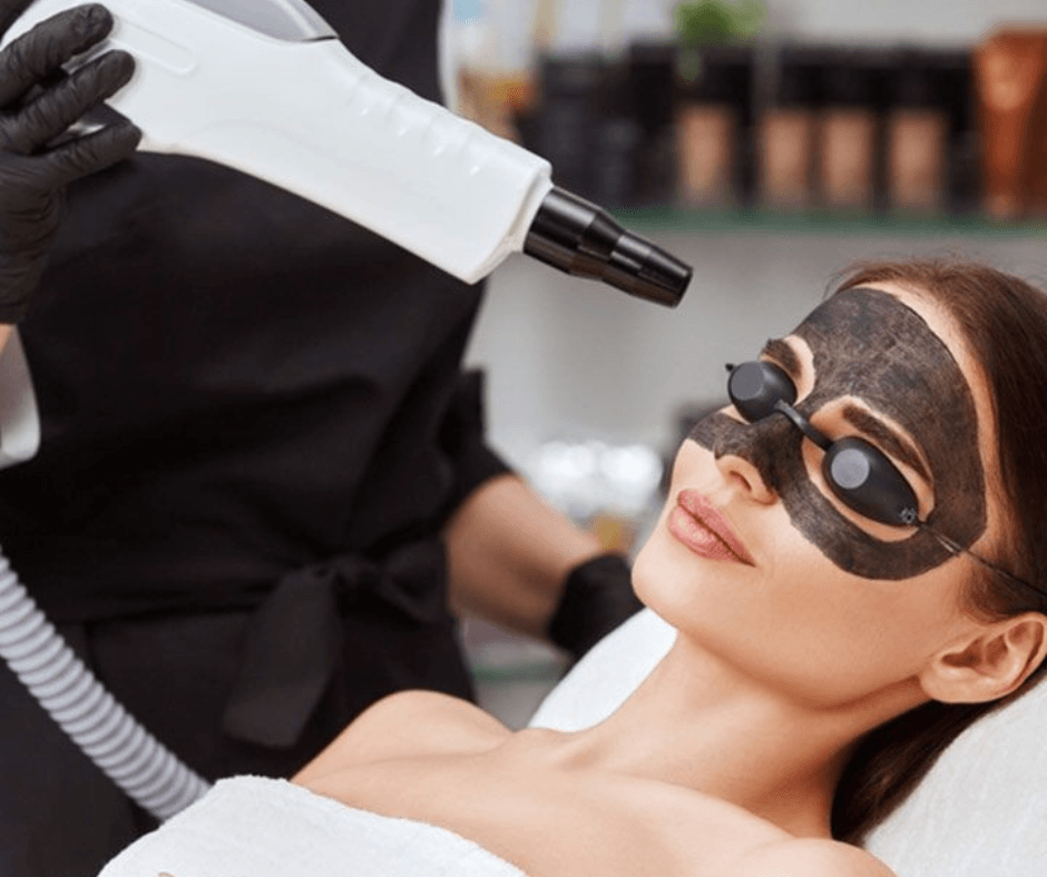 Hollywood Peel o Carbon Peel