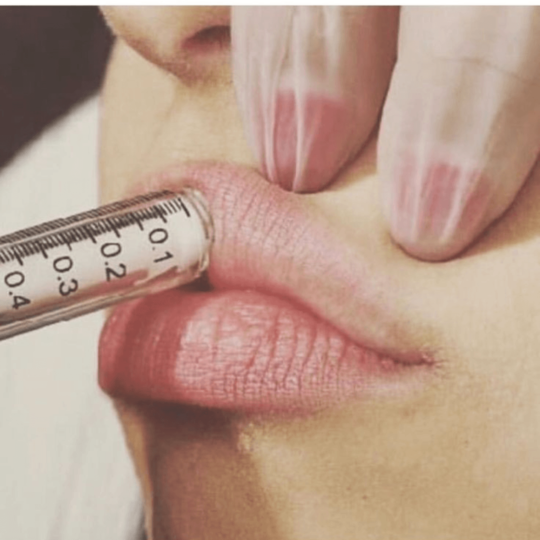 Hyaluron Pen Russian Lips